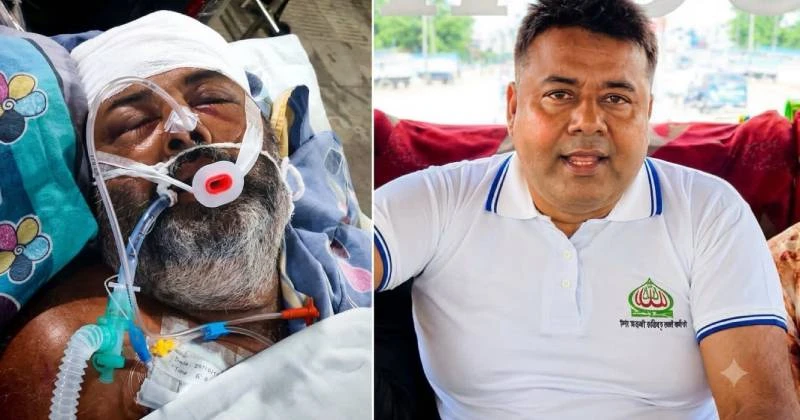 বগুড়ায় হামলায় আহত জামায়াত নেতা ১০ দিন পর মারা গেলেন