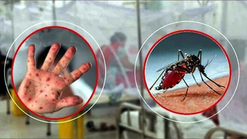 ডেঙ্গুতে আরও ৭ জনের মৃত্যু, হাম উপসর্গে ১