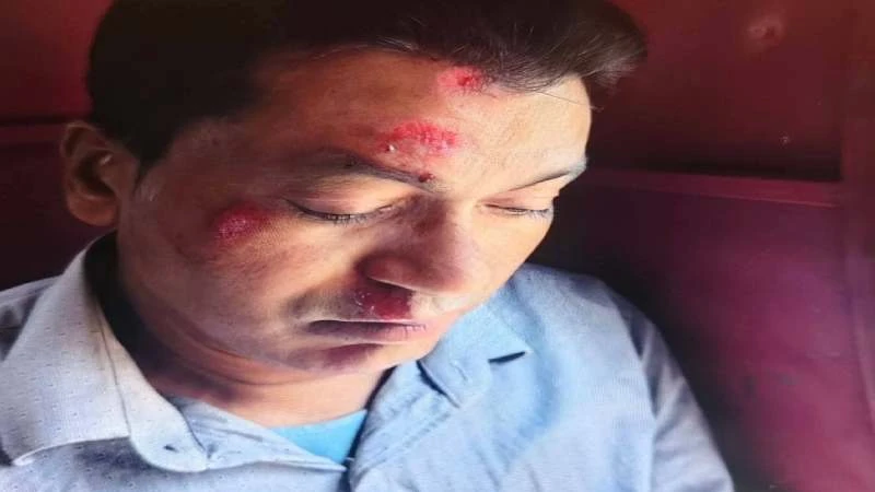 ধামরাইয়ে কাকরান এলাকায়  হামলার ঘটনায় আহত আবুল হোসেনের মৃত্যু