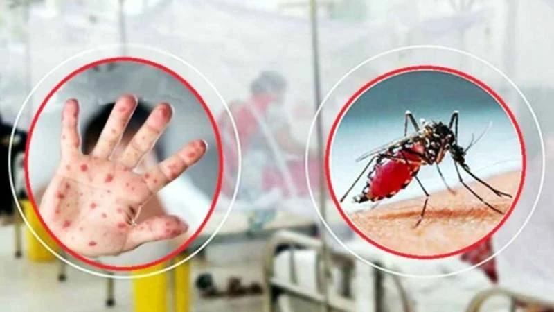 হাম উপসর্গে ৫ ও ডেঙ্গুতে ৩ জনের মৃত্যু