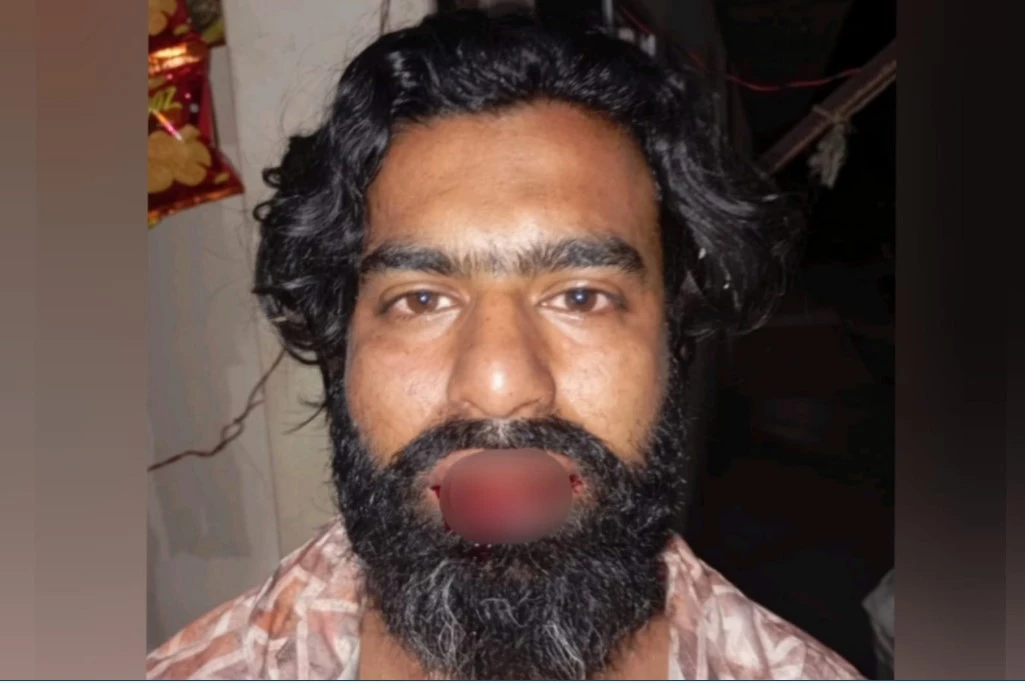 মতলব উত্তরে ফিলিং স্টেশনে হামলায় আহত ছাত্রনেতা