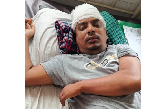 আড়াইহাজারে বসতবাড়িতে দুর্ধর্ষ ডাকাতি, আহত দুই সহোদর