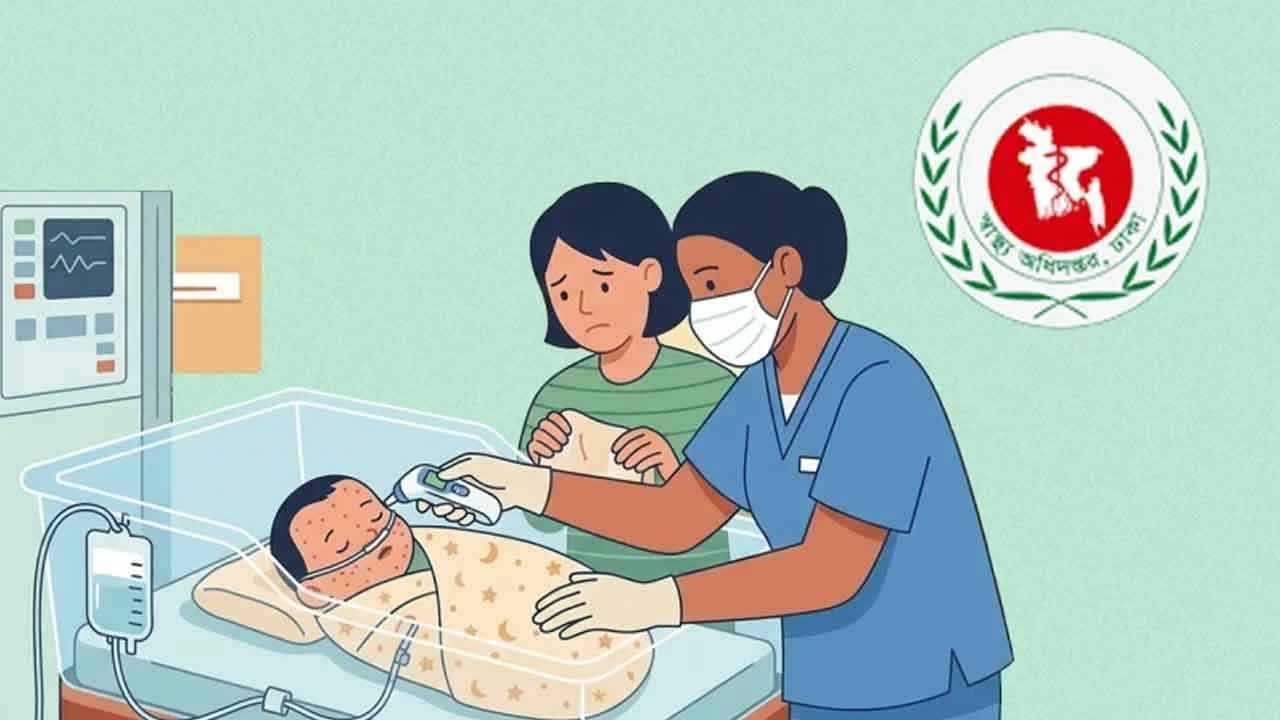 হামের উপসর্গ নিয়ে আরও ৫ শিশুর মৃত্যু